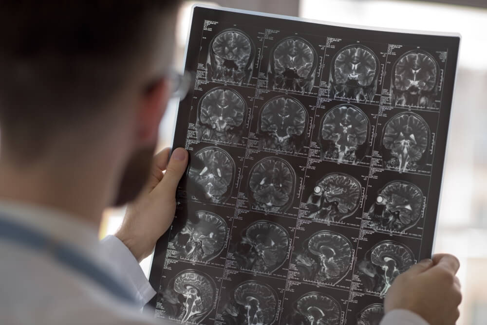 CT and MRI Imaging Presented by PostDICOM